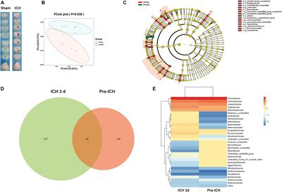 Gut Microbiota Dysbiosis Induced by Intracerebral Hemorrhage Aggravates Neuroinflammation in Mice